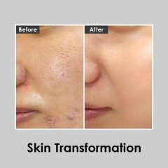 Alternative view of تونر اسانس پپتید 9 آکوا  مدی-پیل