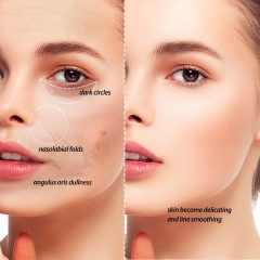 Alternative view of کرم کوشن بی‌بی کاخ تابستانی کتکین