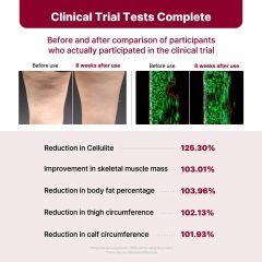 Alternative view of دستگاه لاغری و فرم‌دهی پاها لگ‌سین 