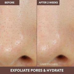 Alternative view of ماسک منافذ چرخشی آتشفشانی اینیسفری