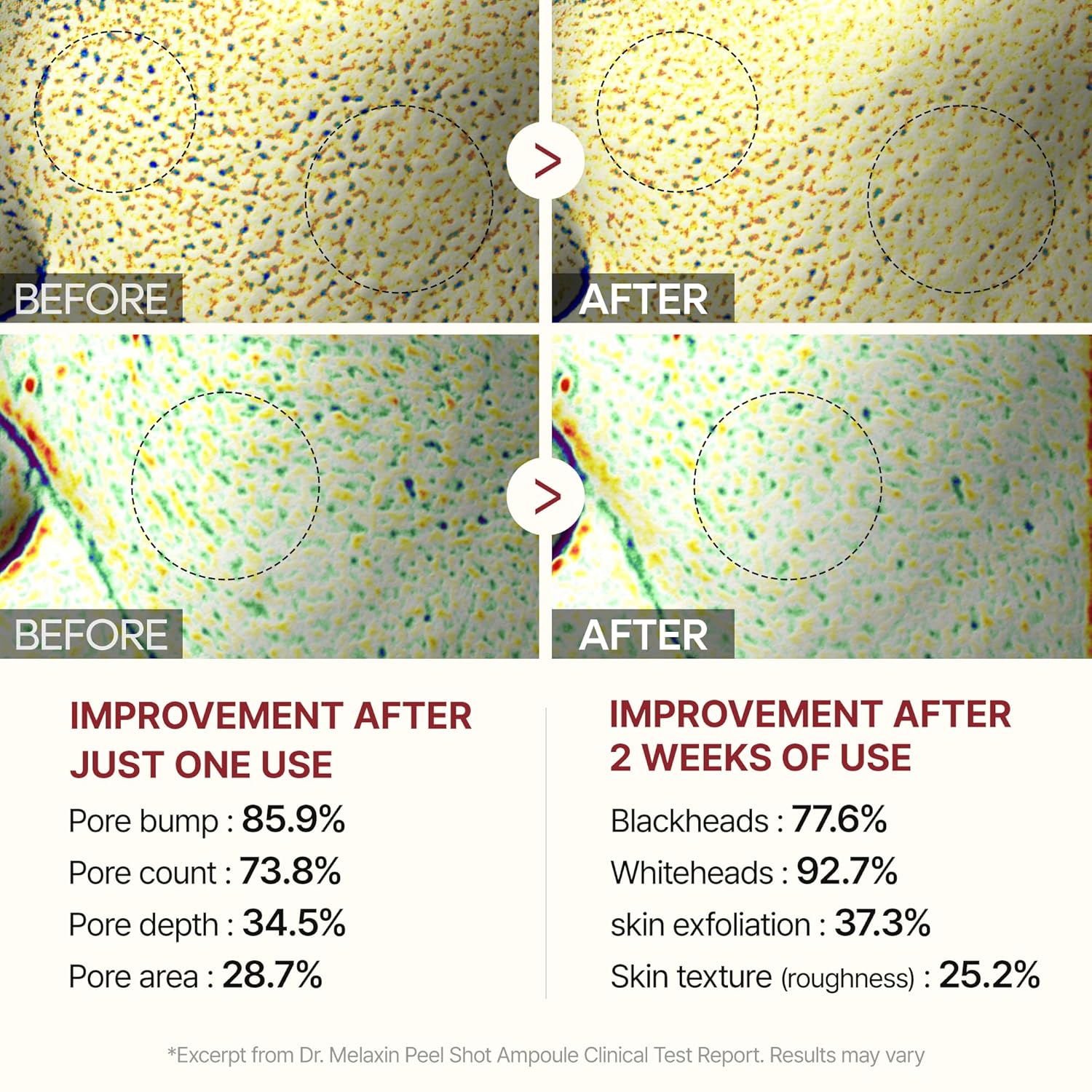 سرم لایهبردار برنج دکتر ملاکسین - تصویر 7
