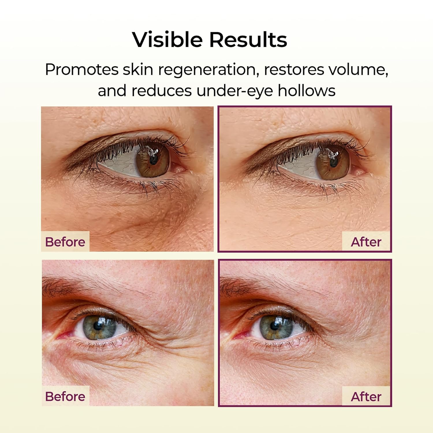 بالم چندکاره و حجمدهنده کلسیم دکتر ملاکسین - تصویر 6