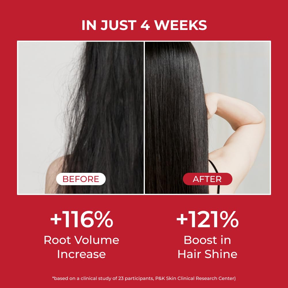 شامپو آنورکاتین مو ایو - تصویر 4