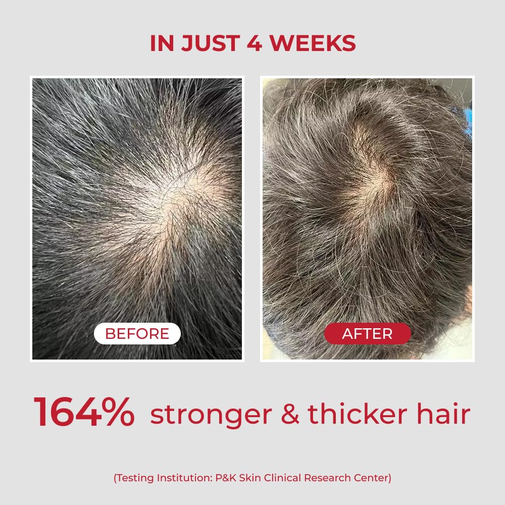 شامپو آنورکاتین مو ایو - تصویر 7