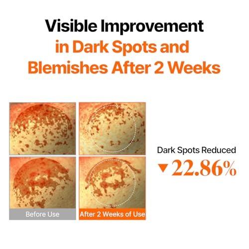 Origin Vitamin C 15% Tone-Up Ampoule | Beginner-Friendly Daily Serum with 15% Premium Pure Vitamin C, Dark Spot Care, Lightweight, Low-Irritation Formula for Sensitive Skin, Korean Skin care